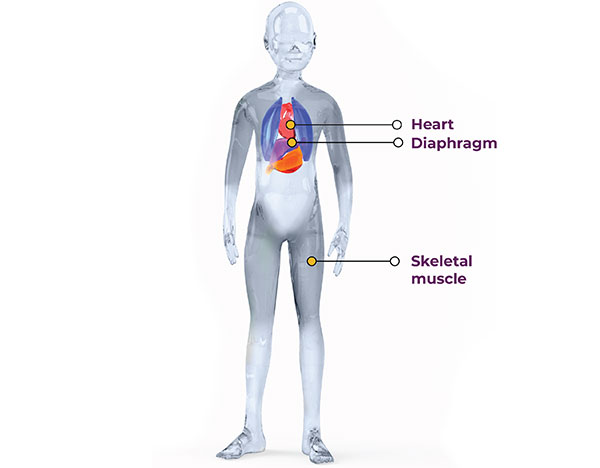 duchenne muscular dystrophy gene