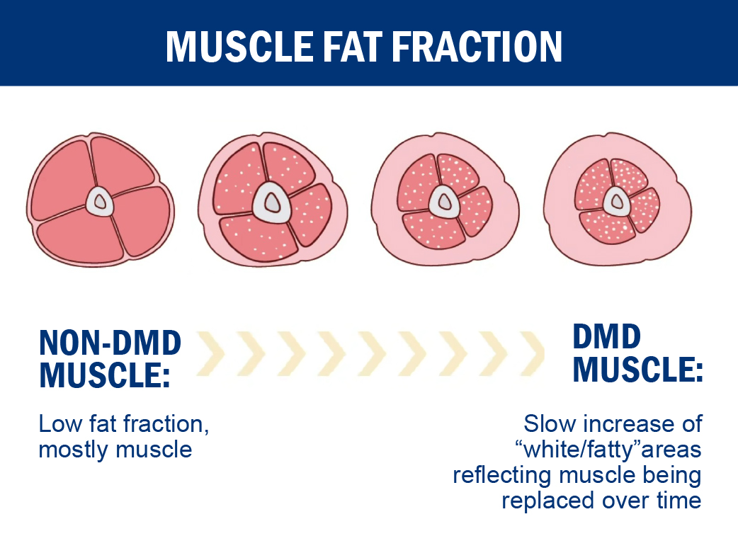 muscle fat fraction graphic